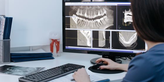 are digital dental x rays safe